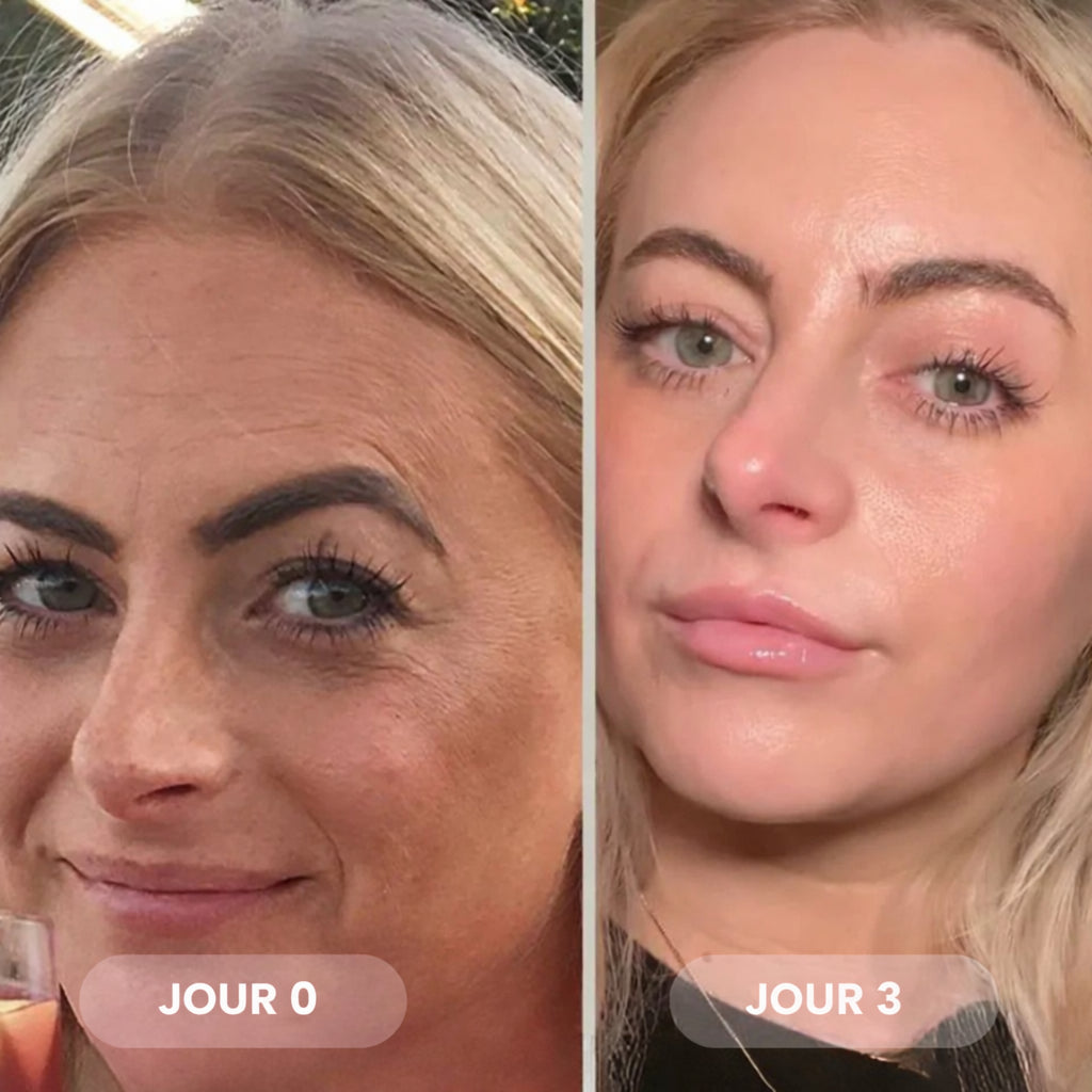 Masque Bio-Collagène – Réduit les rides de 75 % dès la première application
